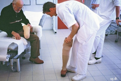 Protese - Det kunstige ben giver næsten normal førlighed.
